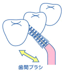 歯間ブラシ