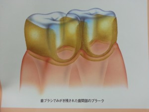 20150122_141257
